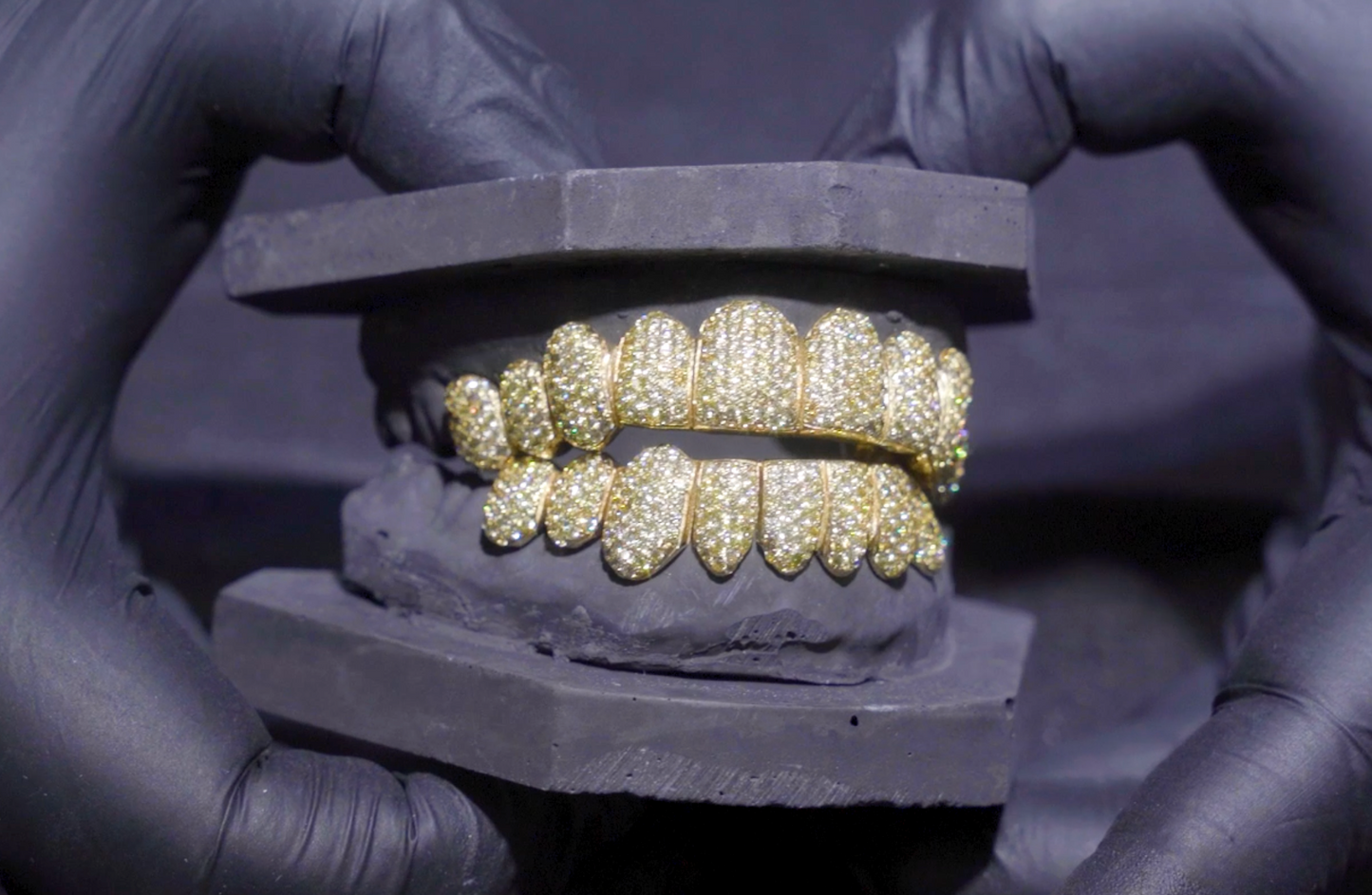 Yellow Canery Grillz