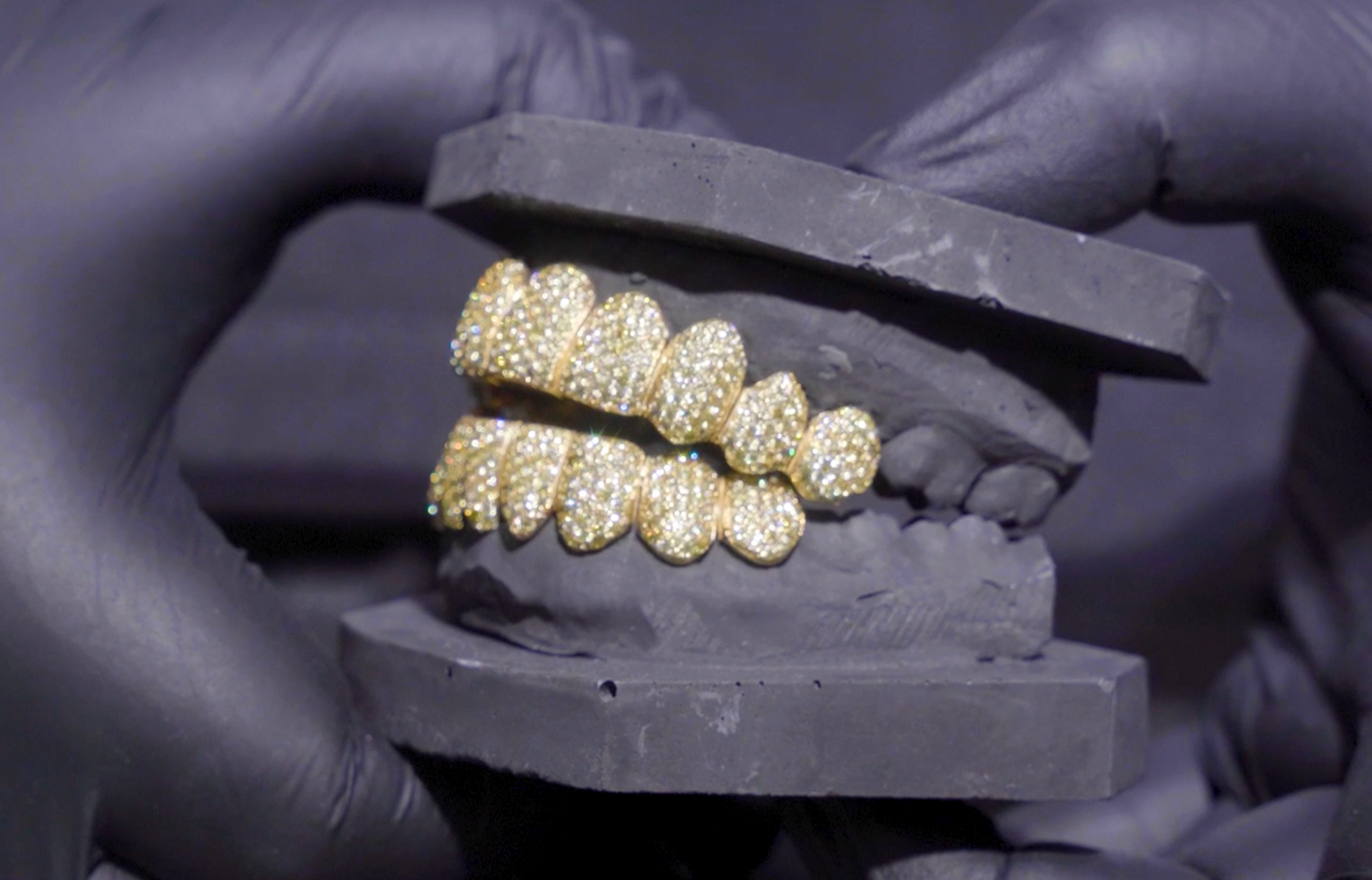 Yellow Canery Grillz