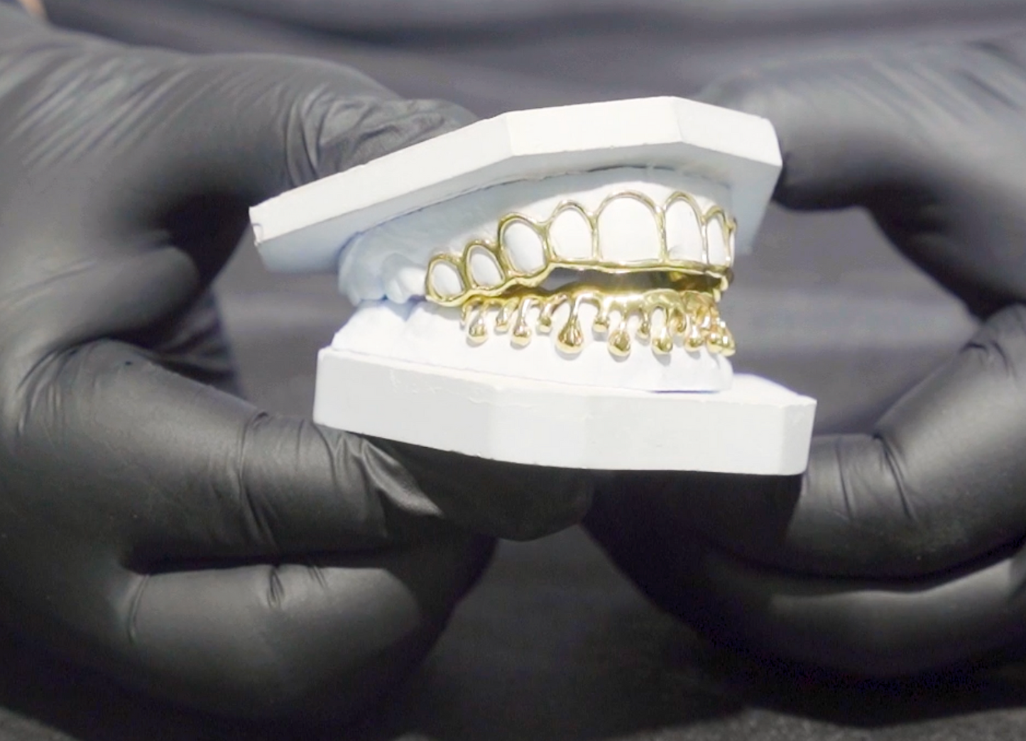 Yellow Gold Open Face Drip Custom Grillz