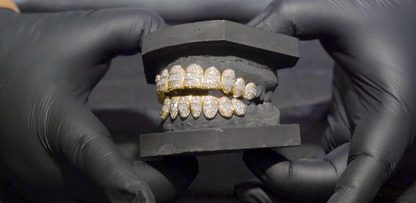 Yellow Gold Diamond Hybrid Grillz