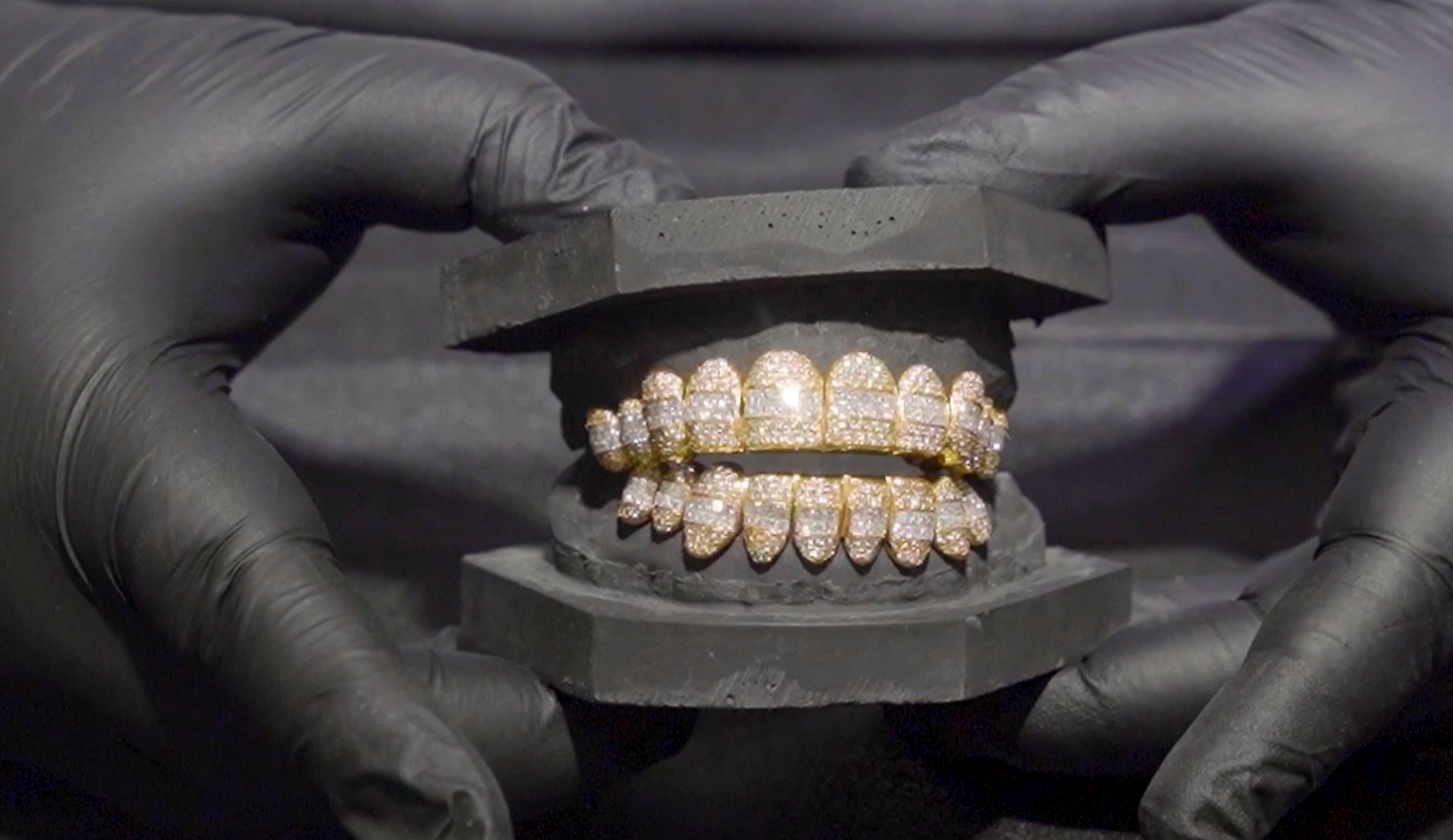 Yellow Gold Diamond Hybrid Grillz