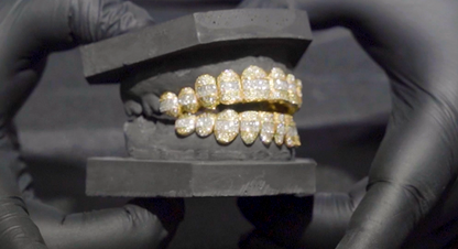 Yellow Gold Diamond Hybrid Grillz